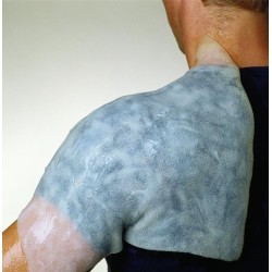 Anti-burn dressings BurnFree Anti-burn dressings BurnFree