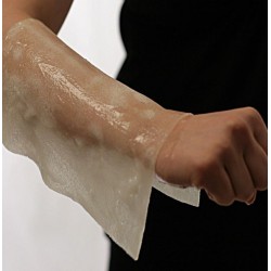 Anti-burn dressings BurnFree Anti-burn dressings BurnFree