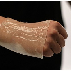 Anti-burn dressings BurnFree Anti-burn dressings BurnFree