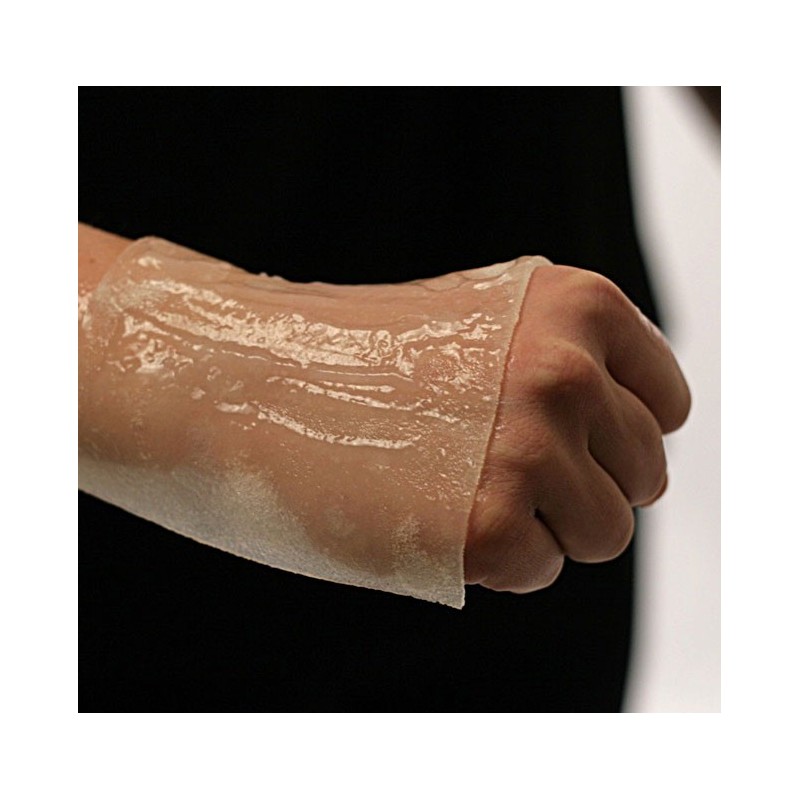 Anti-burn dressings BurnFree Anti-burn dressings BurnFree