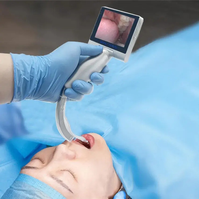 Videolaringoscopio IES Medical Videolaringoscopio IES Medical