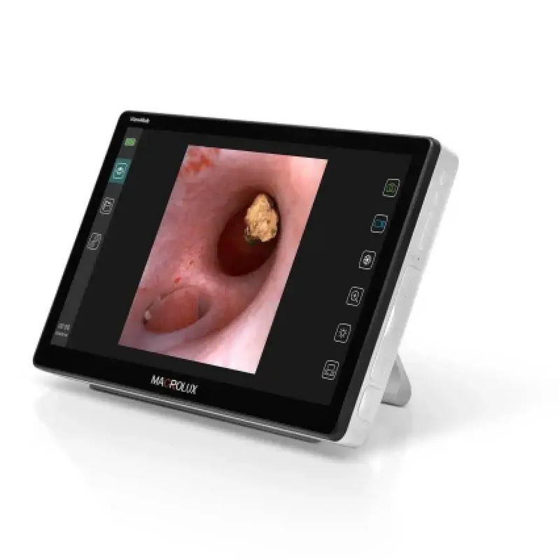 Loop view bronchoscope Macrolux Loop view bronchoscope Macrolux