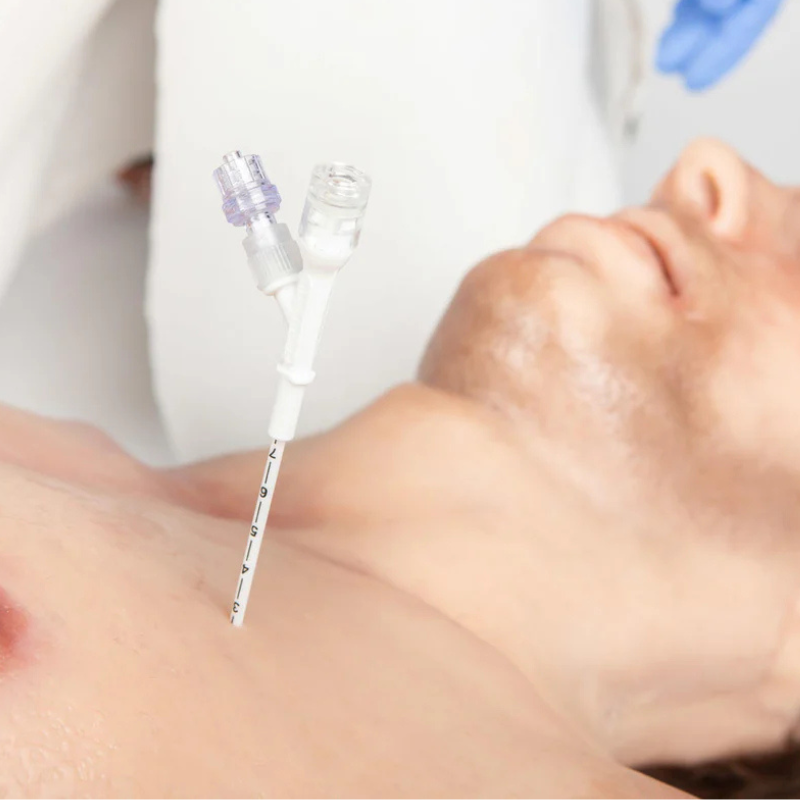 Pneumofix-8 decompression needle | IES Medical Pneumofix-8 decompression needle | IES Medical