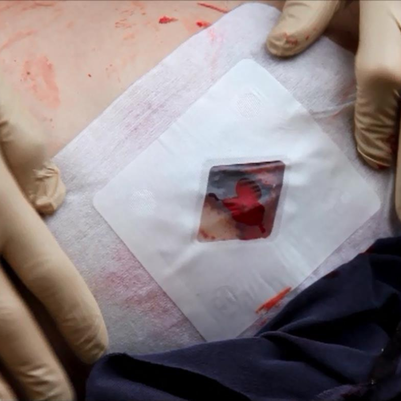 Apósito Torácico Russel | IES Medical Shop Apósito Torácico Russel | IES Medical Shop