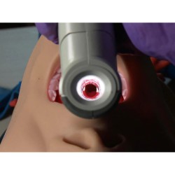 Laryngoscope Vie Scope